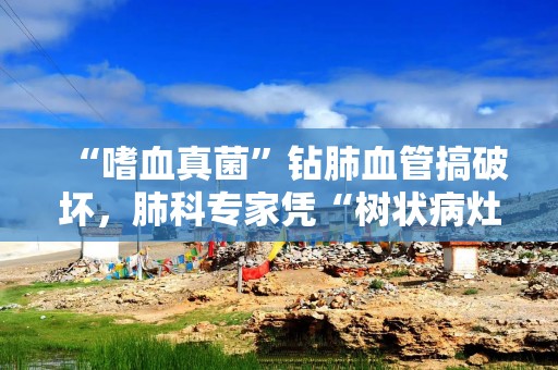 “嗜血真菌”钻肺血管搞破坏，肺科专家凭“树状病灶”破半年“迷案”