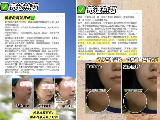 推广|| 她们新年状态大开挂?原来悄悄做了这笔“美丽投资”