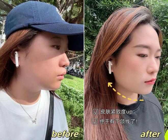 推广|| 她们新年状态大开挂?原来悄悄做了这笔“美丽投资”