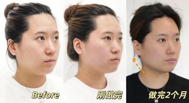 推广|| 她们新年状态大开挂?原来悄悄做了这笔“美丽投资”