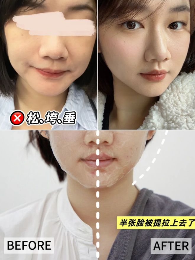 推广|| 她们新年状态大开挂?原来悄悄做了这笔“美丽投资”