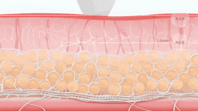 推广|| 她们新年状态大开挂?原来悄悄做了这笔“美丽投资”