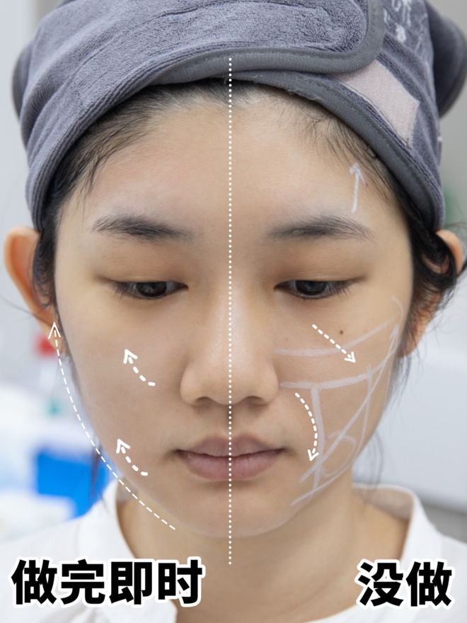 推广|| 她们新年状态大开挂?原来悄悄做了这笔“美丽投资”