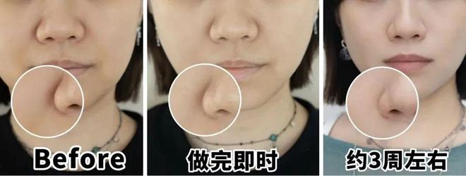 推广|| 她们新年状态大开挂?原来悄悄做了这笔“美丽投资”