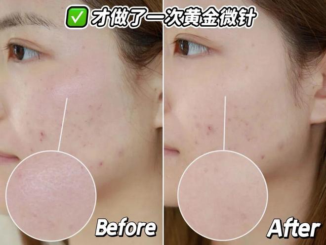 推广|| 她们新年状态大开挂?原来悄悄做了这笔“美丽投资”