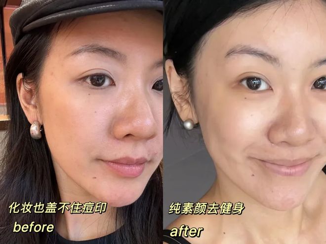 推广|| 她们新年状态大开挂?原来悄悄做了这笔“美丽投资”