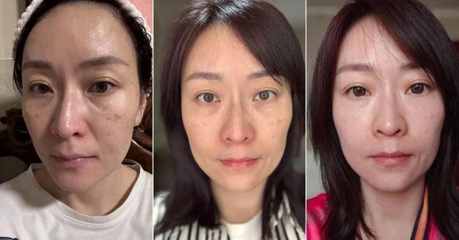 推广|| 她们新年状态大开挂?原来悄悄做了这笔“美丽投资”