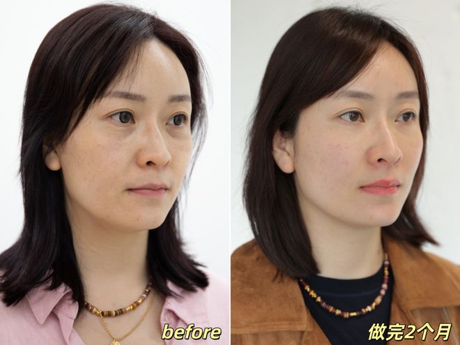 推广|| 她们新年状态大开挂?原来悄悄做了这笔“美丽投资”