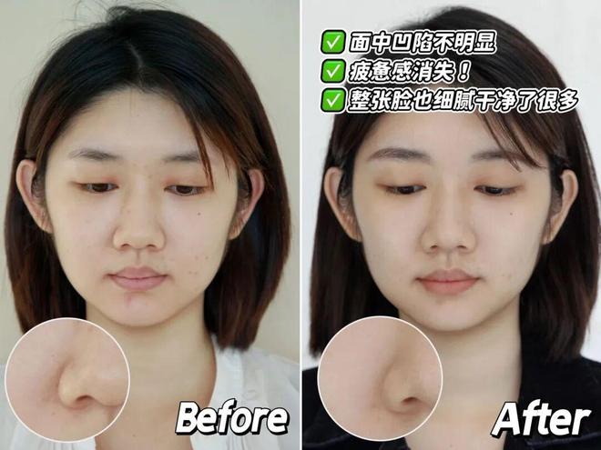 推广|| 她们新年状态大开挂?原来悄悄做了这笔“美丽投资”