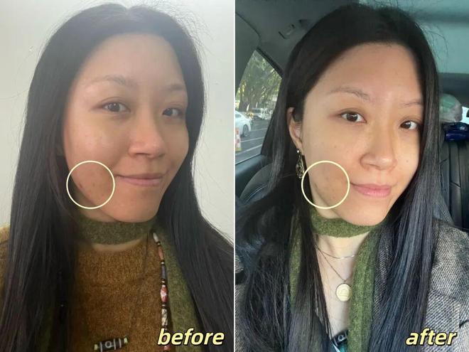 推广|| 她们新年状态大开挂?原来悄悄做了这笔“美丽投资”