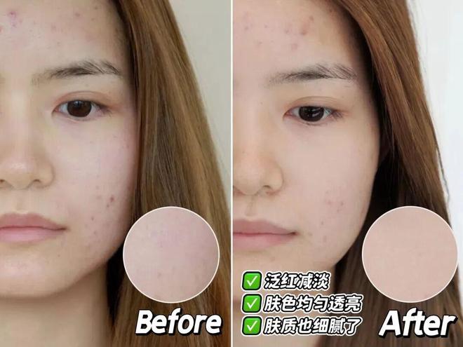 推广|| 她们新年状态大开挂?原来悄悄做了这笔“美丽投资”