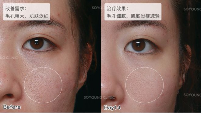 推广|| 她们新年状态大开挂?原来悄悄做了这笔“美丽投资”