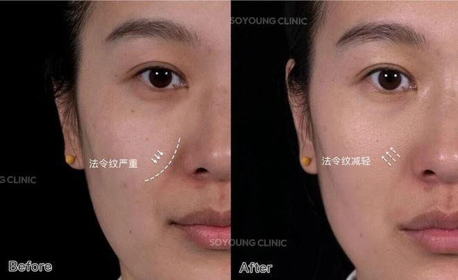 推广|| 她们新年状态大开挂?原来悄悄做了这笔“美丽投资”