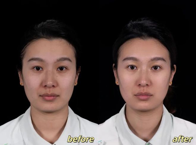 推广|| 她们新年状态大开挂?原来悄悄做了这笔“美丽投资”