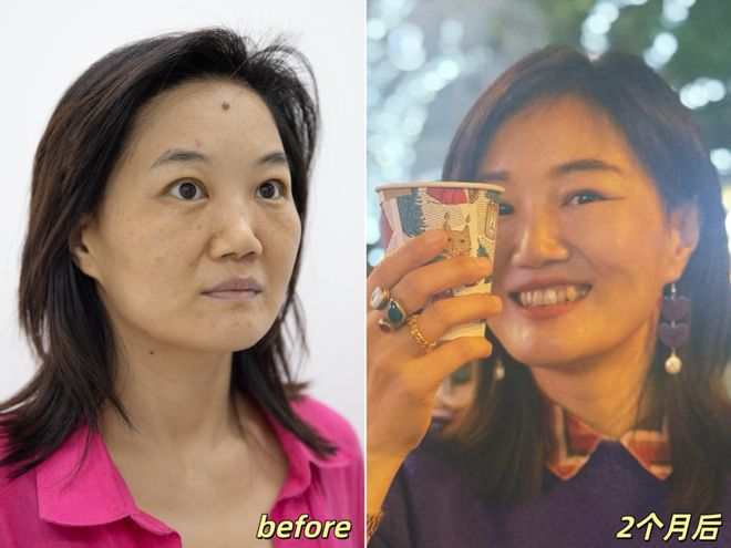 推广|| 她们新年状态大开挂?原来悄悄做了这笔“美丽投资”